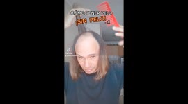 Instant bald to hair transformation: Peruvian TikTok Sensation gained major attention with over 10 million views on TikTok