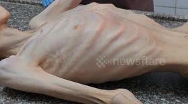 Palestinian teen dies from malnutrition amid Gaza blockade