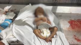 Infant dies from malnutrition due to Israeli blockade in Gaza