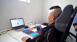 China: Chinese hospitals accelerate clinical applications of brain-computer interfaces