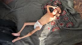 10-year-old Gazan child with brain condition drops to 8 kg due to Israeli blockade
