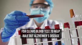 FDA Clears Blood Test To Help Rule Out Alzheimer's Disease