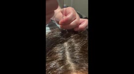 Hair pulling head massage goes wrong when therapist pulls out clump of strands