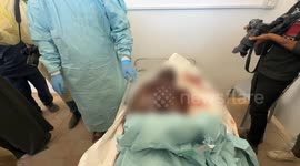 Bodies returned by Israel show signs of torture: Gaza Health Ministry