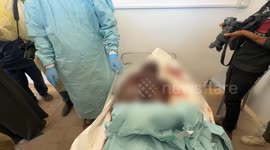 Bodies returned by Israel show signs of torture: Gaza Health Ministry