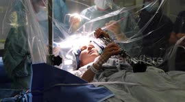 Brain surgery patient plays clarinet during operation to stay awake
