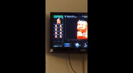London Hospital Miracle: Siblings' Voices Make Baby Smile on 4D Scan