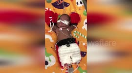 US: Tiny Heroes In Costumes Melt Hearts At Cleveland Clinic Childrens