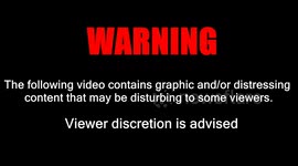 Baby's toe 'ripped off' in piranha attacks on bathers at Amazon River resort