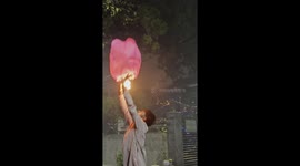 Man shows burn after sky lantern mishap in Delhi, India