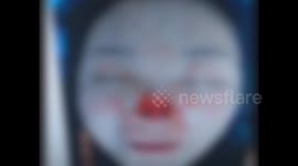 Man bites off wife's nose because she litigates to divorce