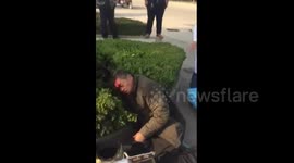 Helmet rescues scooter driver's life when he is hit by falling down street light