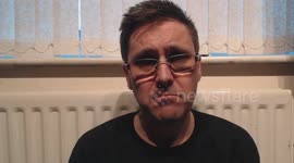 living with Pancreatitis, a brief history