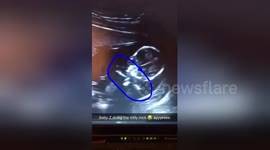 Unborn baby performs the 'Milly Rock' dance