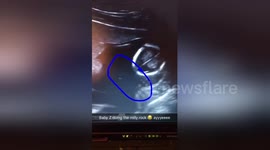 Unborn baby performs the 'Milly Rock' dance