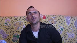 The men with only half of the skull