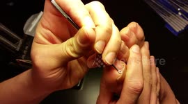 Picking & Cringing (yuck)