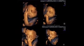 Cheeky wee baby swearing during its scan