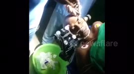 Patient watches movie, hums along during brain surgery