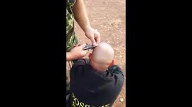 Fisherman gets hook stuck in his head