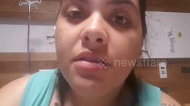 Fast food addict is now 38lbs lighter after losing almost half her bodyweight