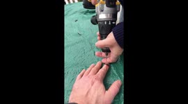 UK man drills finger wound to 'release pressure' after trapping it in door