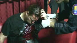 Tourist whacked with ash tray for refusing to pay strip bar bill