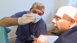 UK man gets a hair transplant