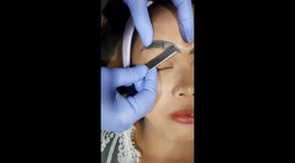 Woman left with giant slug-like eyebrows after botched tattoo job (vertical clip)