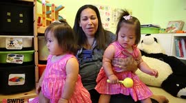 These adorable identical twin toddlers are one-in-a-million - because they have Down’s Syndrome