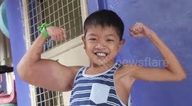 Boy, 11, dubbed 'Popeye' after mystery condition gives him huge biceps