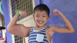 Boy, 11, dubbed 'Popeye' after mystery condition gives him huge biceps