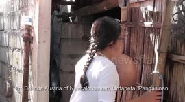 Woman has huge tumour on her chin which started as toothache when she was 13