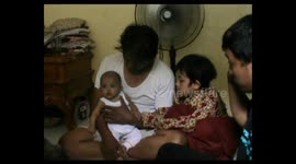 Babies Suffer from Liver Damage in Pekanbaru