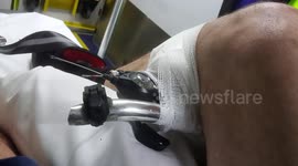 UK cyclist impaled by own bike in freak accident