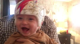 A tiny tot with a flattened head is on the road to recovery thanks to a David Bowie-inspired helmet