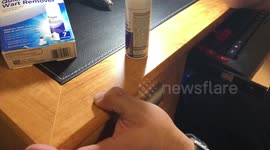 Painful wart freeze funny video