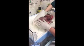 My NewBorn Son/CS Section Delivery/Longhead due to 2 days of labor he really wants to come out.