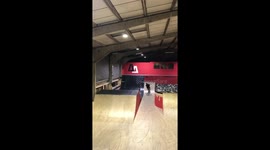 BMX stunt goes wrong - broken cheekbone