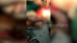 Bizarre diet: Doctors remove over 100 iron nails from man's stomach in north west India