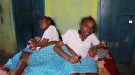 Conjoined twins fused along the abdomen face battle to survive, pleads for help as parents struggle to pay for the operation cost