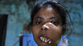 Indian woman with facial tumour cruelly branded 'monkey girl' launches crowdfunding campaign for surgery