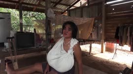 Mystery condition causes Thai woman's breasts to grow uncontrollably, leaving her in pain