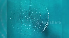 Indian doctors remove a record 526 teeth from seven year old boy's mouth 