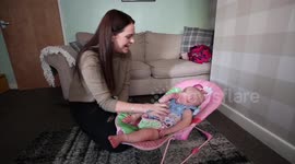 Mother bravely admits she used to hide child with 'purple' birthmarks