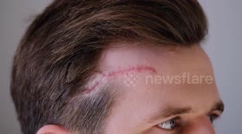 Motorist suffers head injuries after 10kg tow bar smashes through windscreen