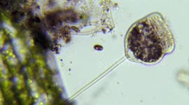 Amazing aquatic microscopic life vorticella feeding
