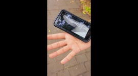 Magician Rips His Finger and POPS back ON