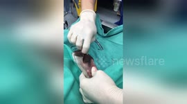 Vet has epic reaction to huge splinter pulled from dog's paw