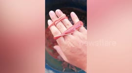 Seemingly never-ending tapeworm coils round woman's hand in Thailand